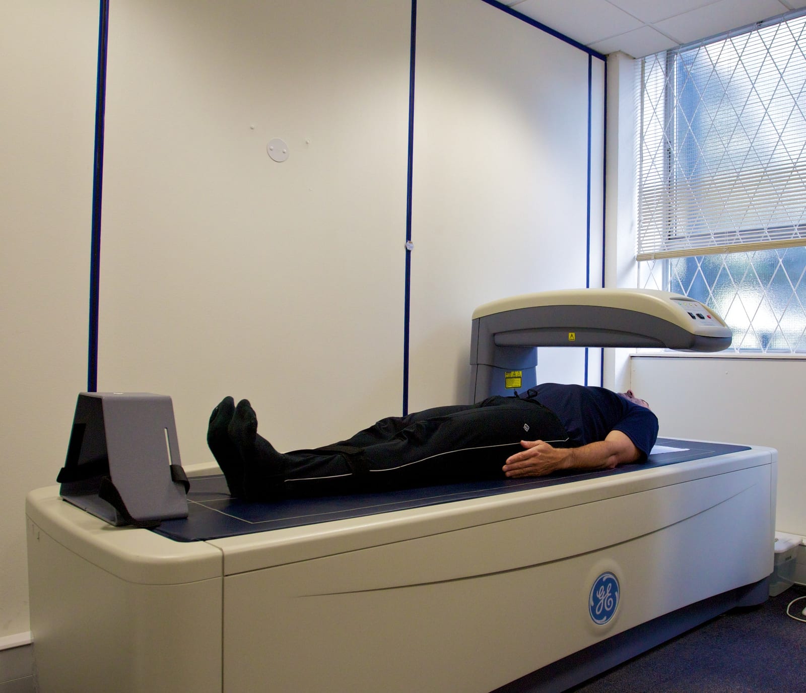 DEXA
